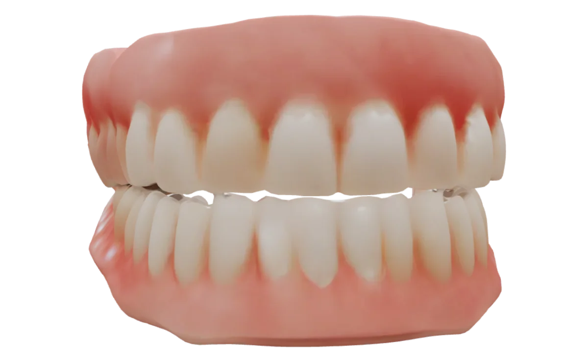 Escaneo intraoral 3D de arcada superior e inferior